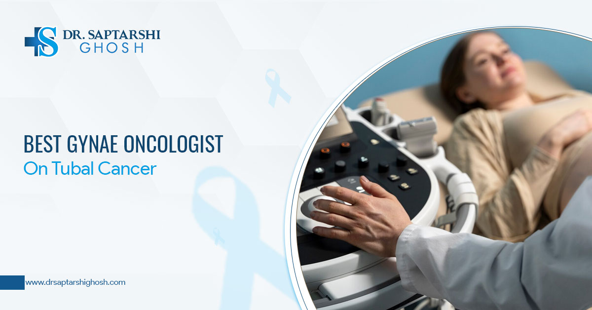 Best Gynae Oncologist On Tubal Cancer