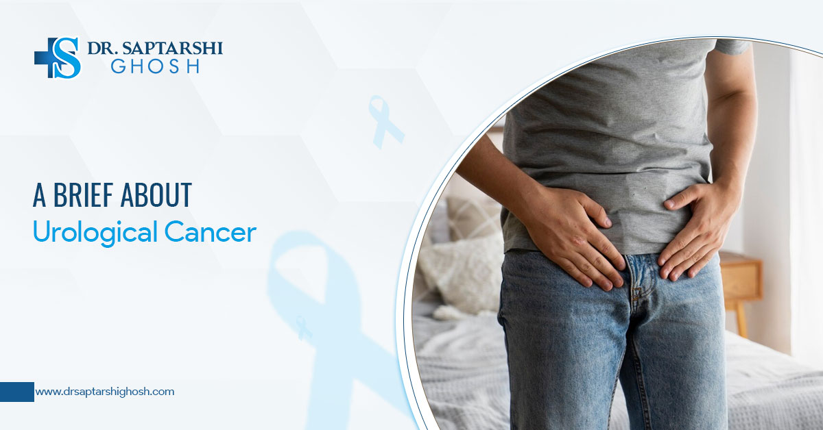 A Brief About Urological Cancer