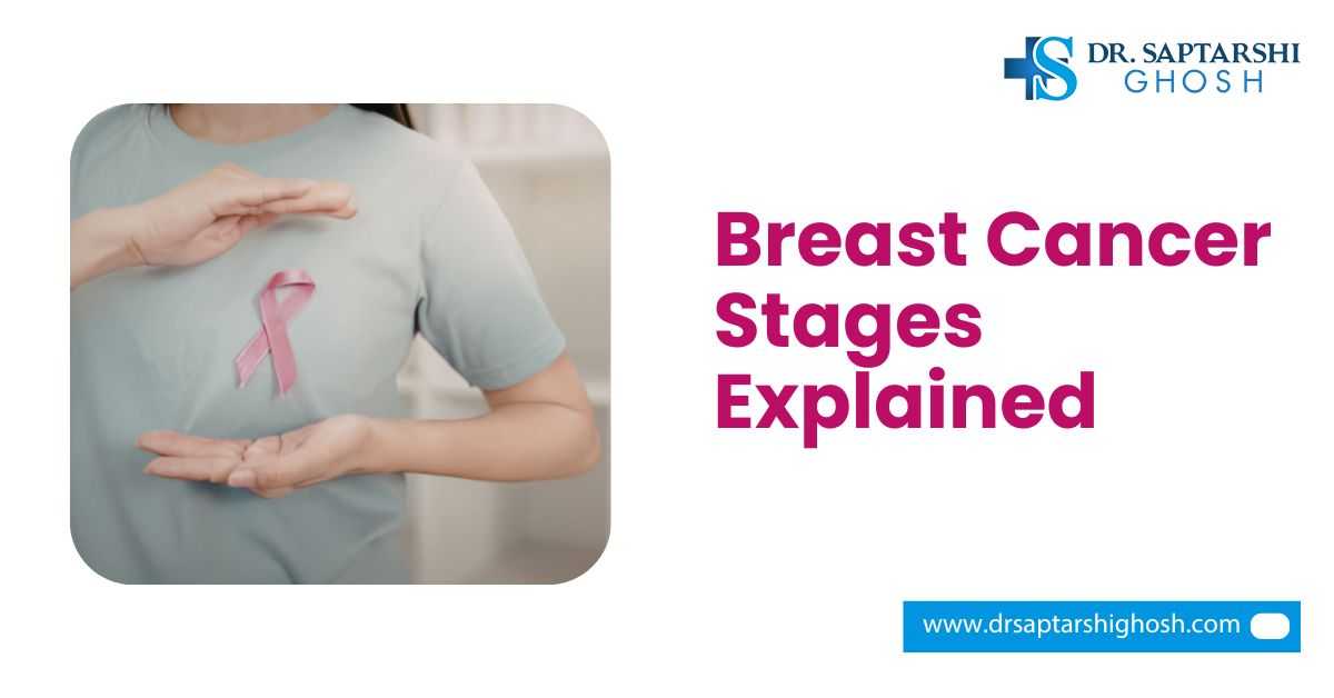 Breast Cancer Stages Explained