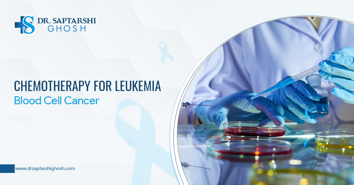 Chemotherapy For Leukemia - Blood Cell Cancer