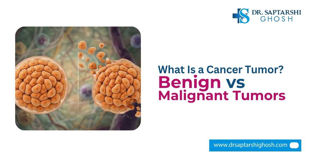 What Is a Cancer Tumor? Benign vs Malignant Tumors