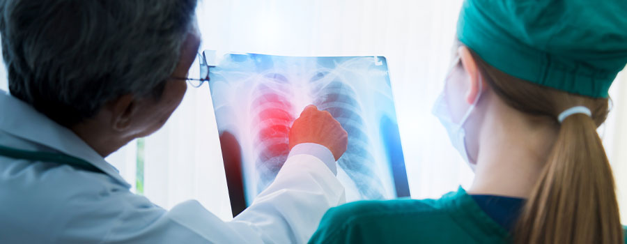 Chest Cancers