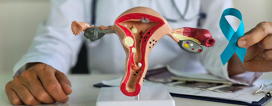 Gynecologic Cancers